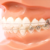 歯列矯正用器具部品